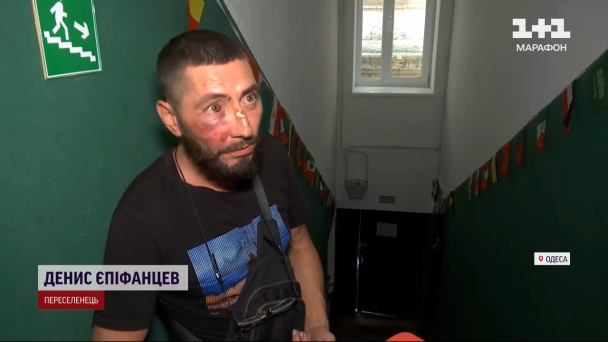 Переселенець з Херсона Денис Єпіфанцев, якого побили поліціянти в Одесі / © ТСН