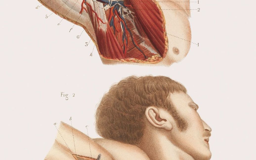 Хирургия 19-го века. / © thamesandhudson.com