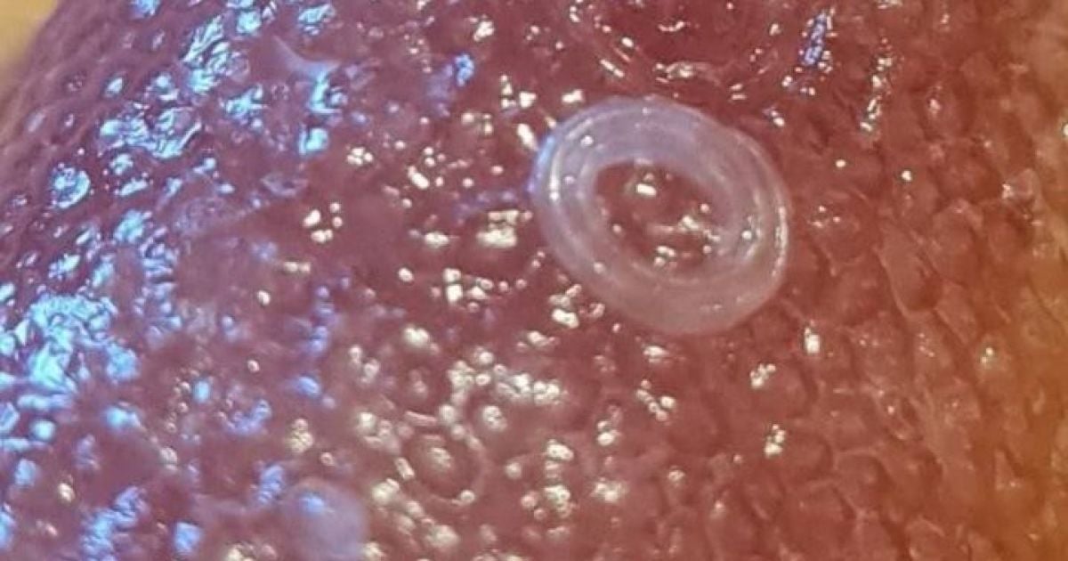 В одному із супермаркетів Києва у рибі знайшли паразитів: фото, відео