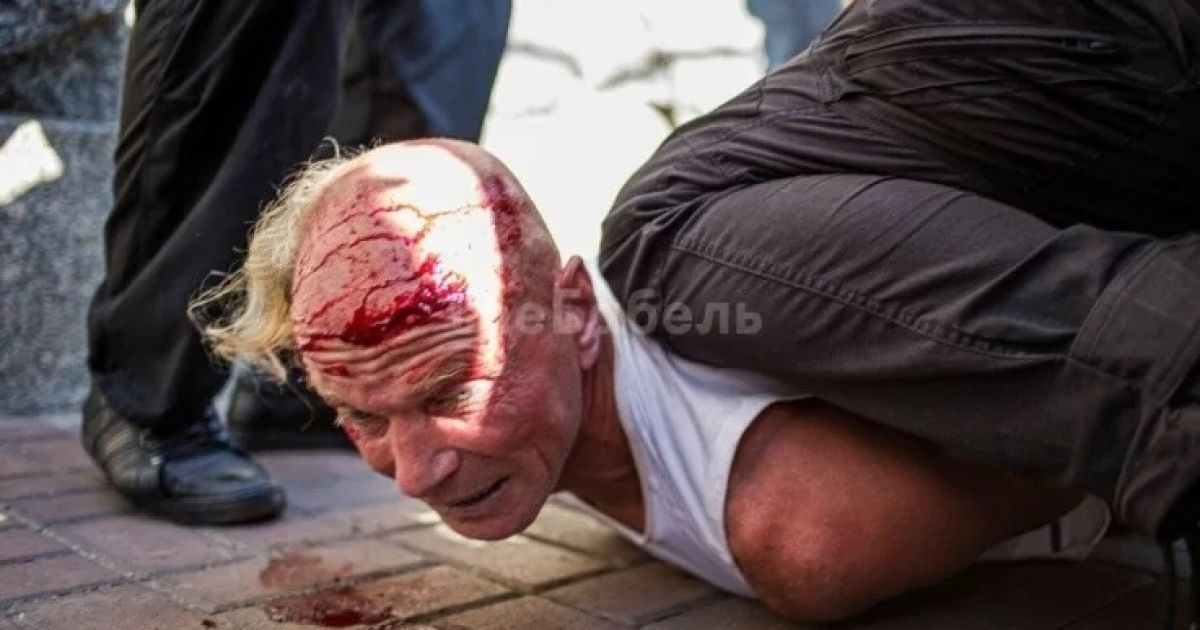 Ветерана, який заліз на огорожу на Майдані під час виступу Зеленського, побили та затримали правоохоронці