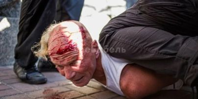 Ветерана, який заліз на огорожу на Майдані під час виступу Зеленського, побили та затримали правоохоронці