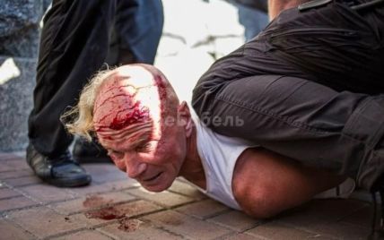 Ветерана, який заліз на огорожу на Майдані під час виступу Зеленського, побили та затримали правоохоронці