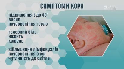 Чи загрожує Україні епідемія кору і як захиститися від  захворювання - інфекціоніст Юрій Жигарєв