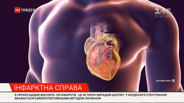 Спасение для людей с болезнями сердца: в Украине появились уникальные врачи и бесплатное стентирование