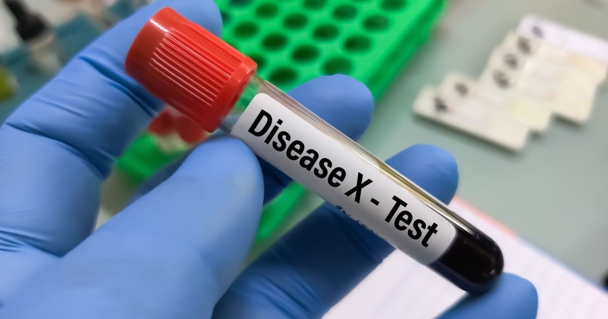 Тест на "хворобу Х" / Фото ілюстративне