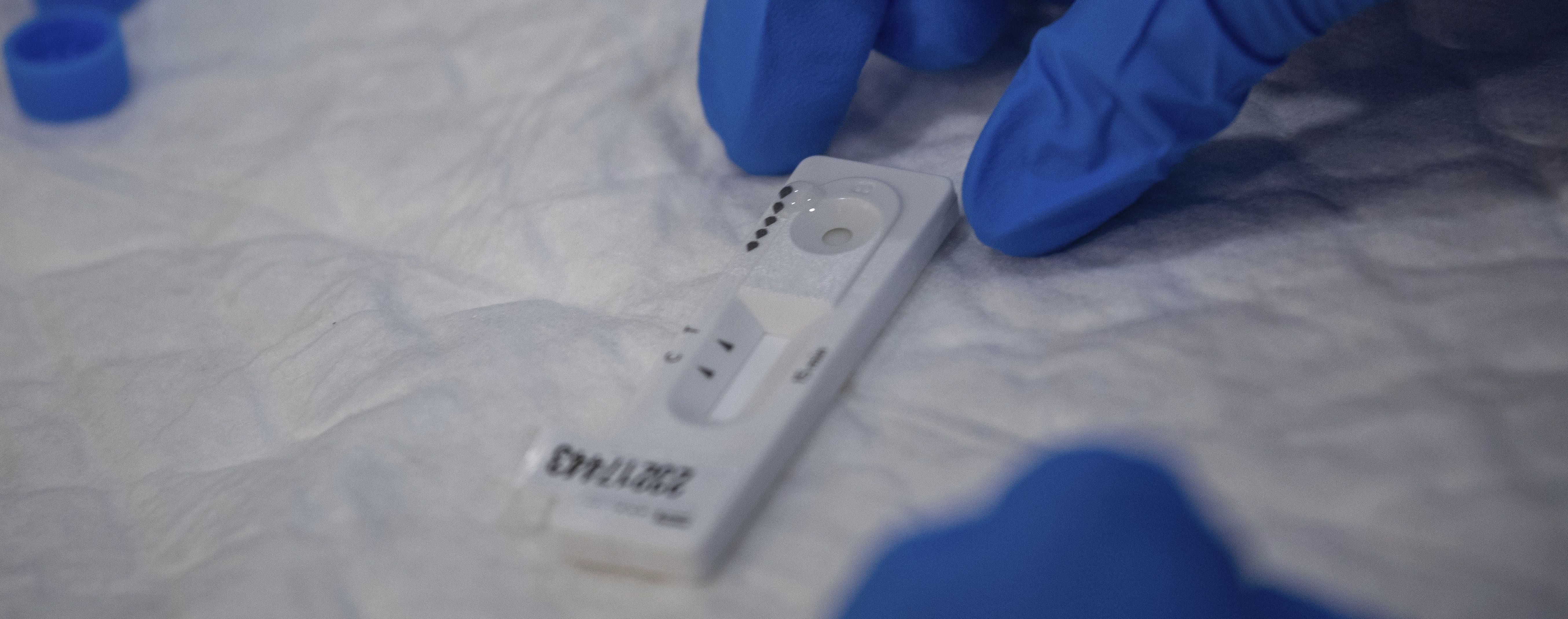 Марна трата грошей: чому тести на антитіла до коронавірусу не потрібно робити