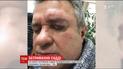 Закривавлене вухо і синці під оком : у столиці побили суддю господарського суду