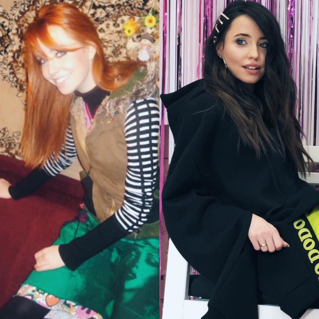 Үлкен жопа гимнастикалық анал