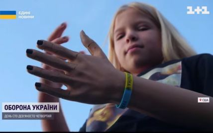 Дівчинка із Гостомеля, якій росіяни відстрелили руку, отримала в подарунок роботизований протез