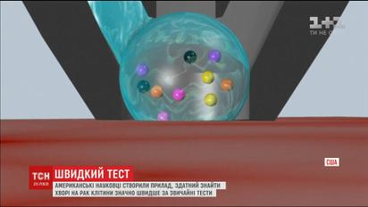 Винахід американських науковців дозволяє за 10 секунд діагностувати рак у людини