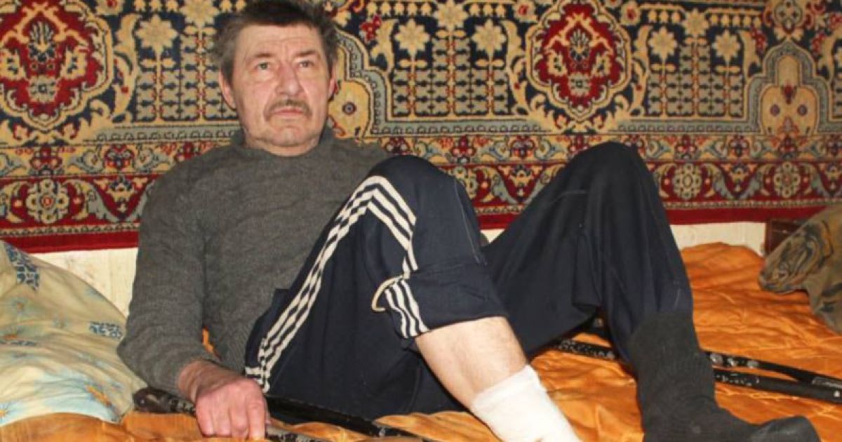 На Сумщині чоловік ампутував собі ступню і викинув її на вулицю. Кінцівку знайшов собака