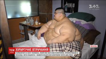 У Мексиці прооперували чоловіка, який важив 600 кілограмів