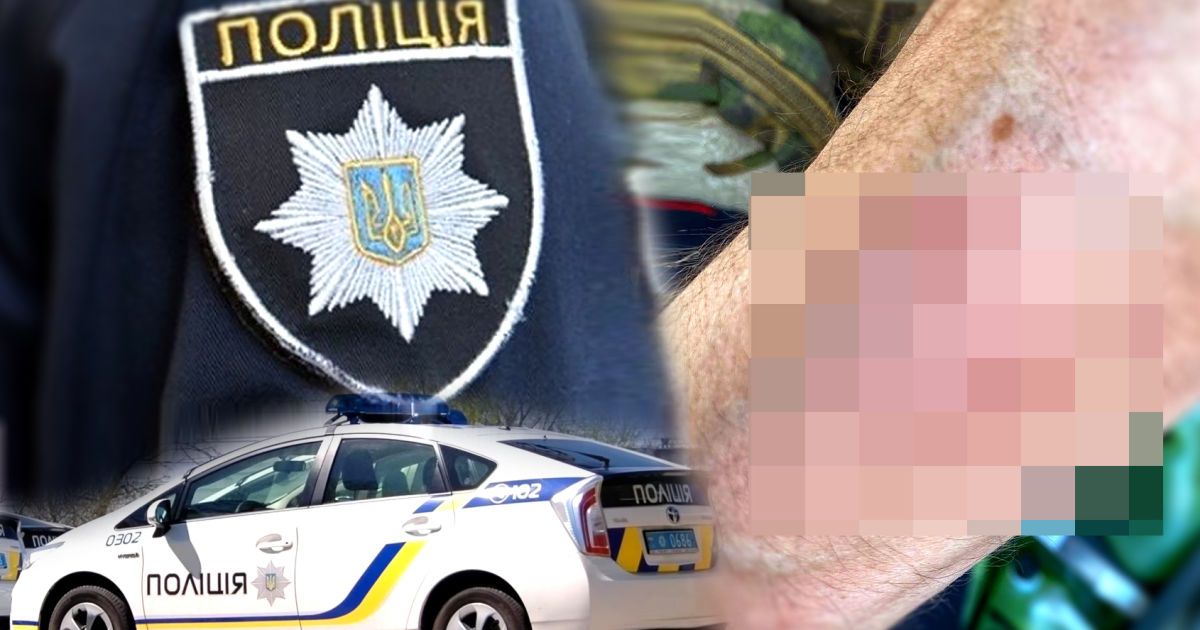 Из-за драки с полицейскими и работниками ТЦК в Одессе возбуждены уголовные производства