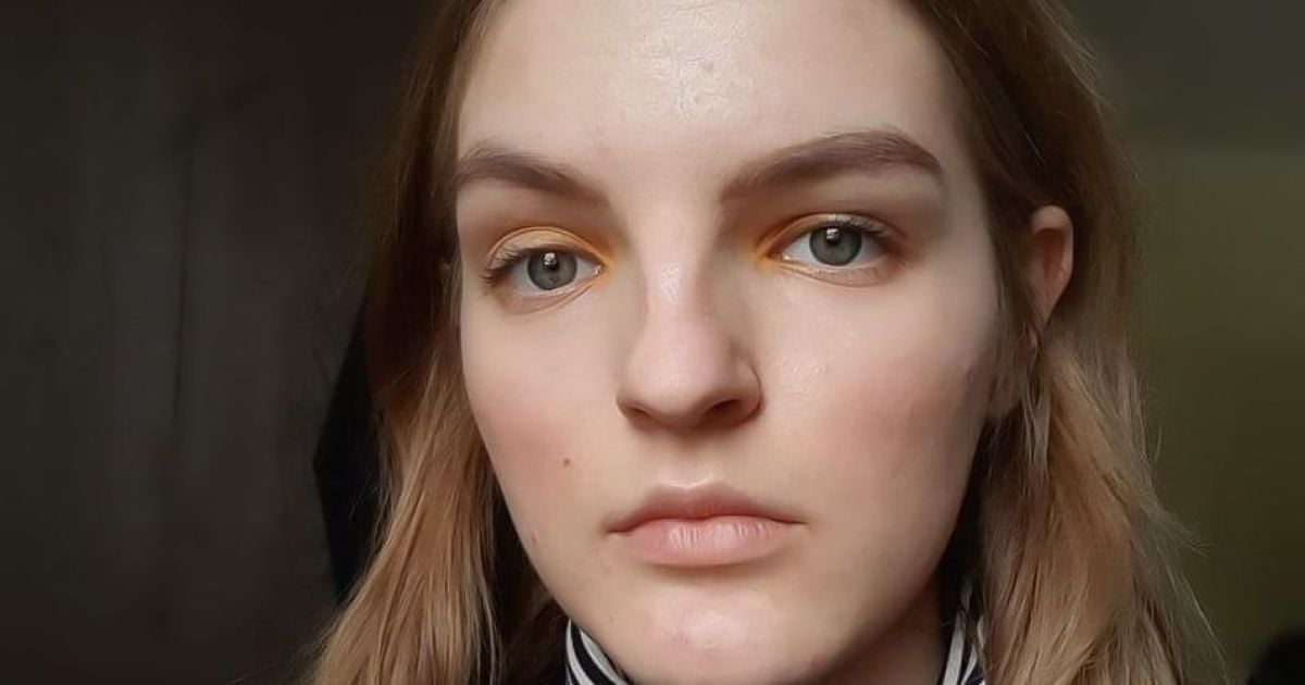 250 тисяч гривень потрібно зібрати Ганні на термінову операцію