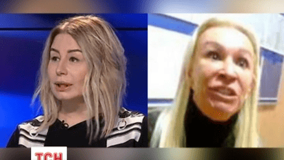 Анна Герман удивила неудачной "пластикой"