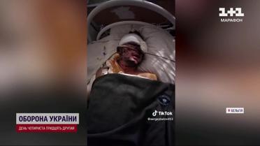 Медична евакуація: закордонні клініки рятують життя українських захисників з важкими пораненнями