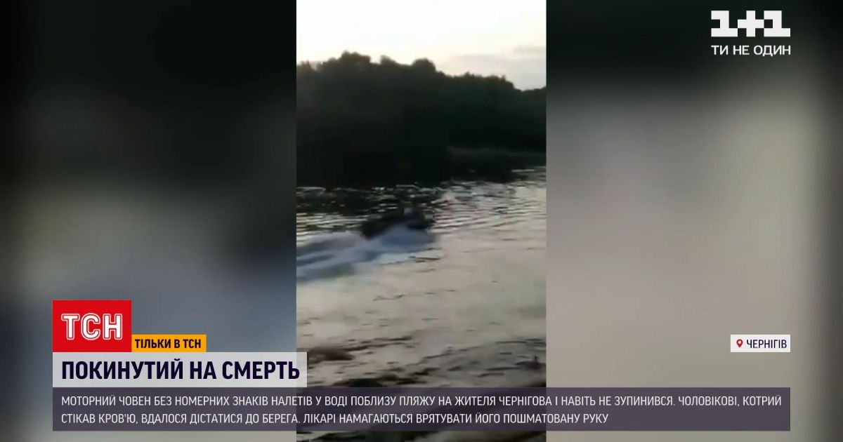 Новости Украины: в Чернигове моторная лодка оторвала руку 40-летнему мужчине