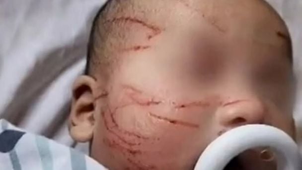 Ной / © 9news.com.au