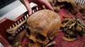 Ученые обнаружили новый иммунный орган в костях черепа