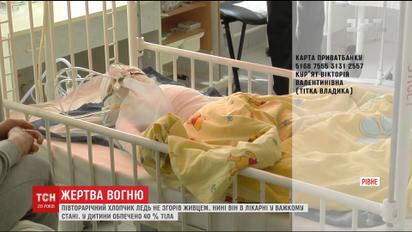 На Рівненщині прооперували півторарічного хлопчика, який ледь не згорів заживо