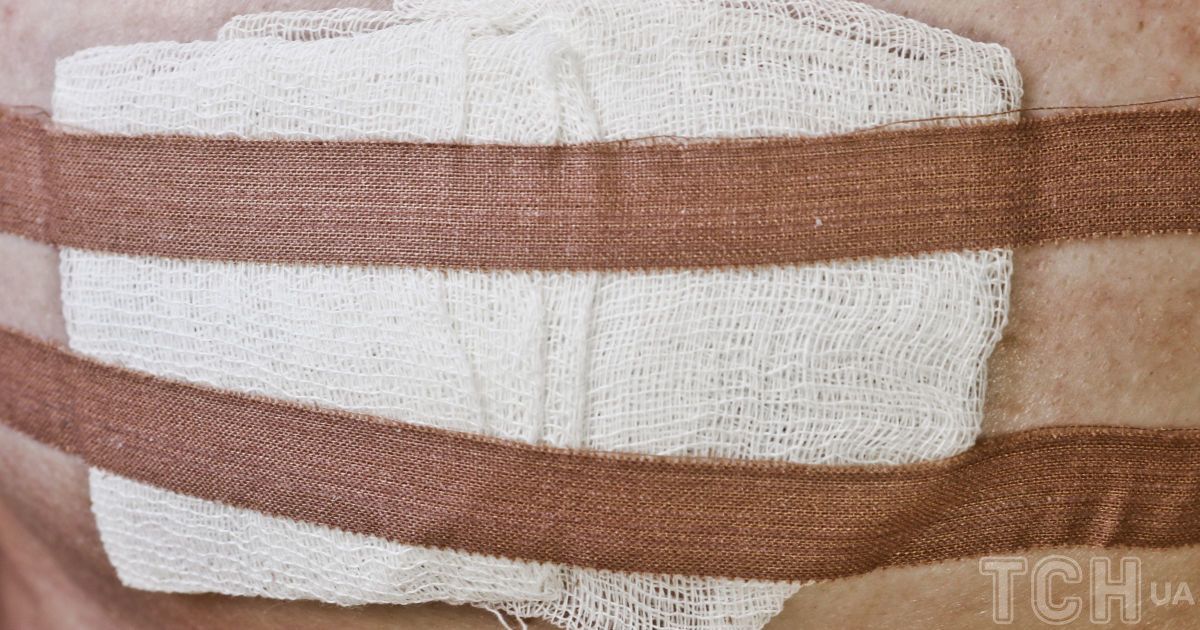 Перев'язування ран