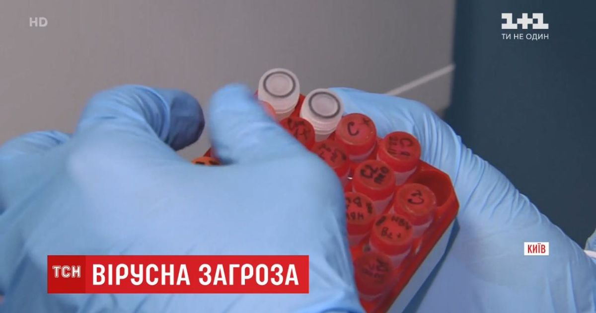 У столичній лабораторії створили тест-систему для діагностики китайського коронавірусу