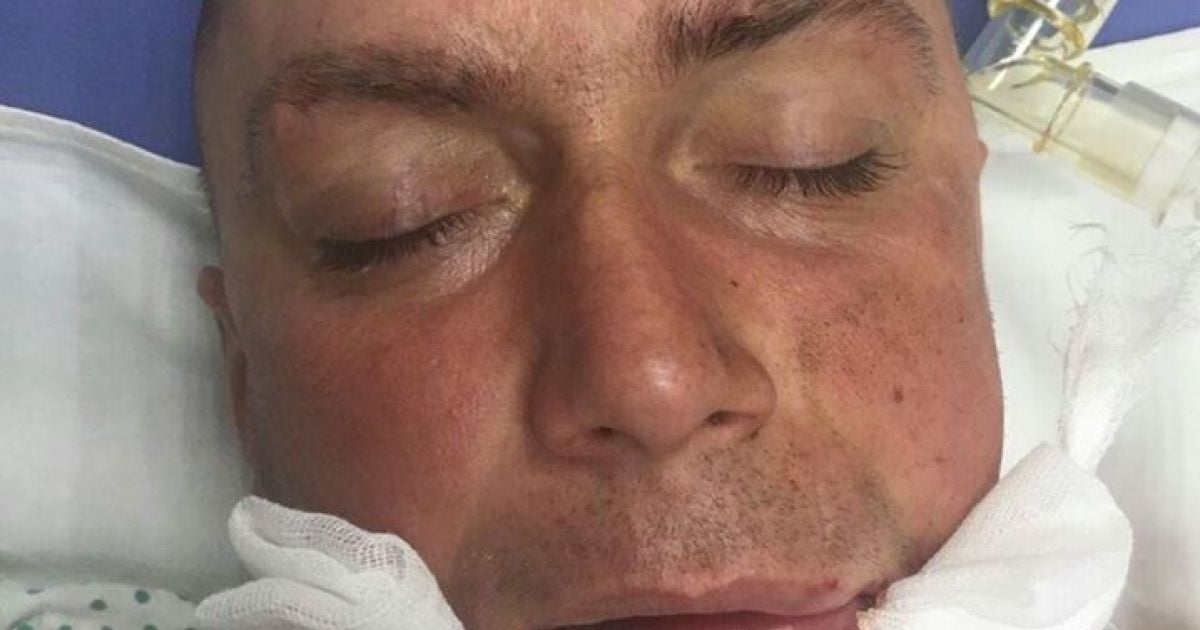 В Харьковской области мужчина потерял сознание посреди улицы и впал в кому. Его личность устанавливает полиция