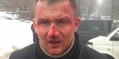Избиение нардепа Левченко в Киеве прокуратура расценила как нападение на госдеятеля