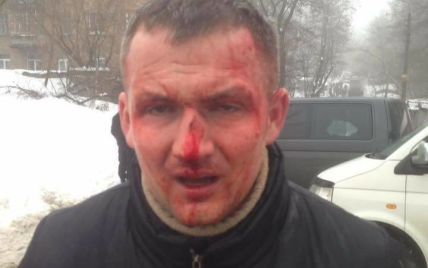 Побиття нардепа Левченка у Києві прокуратура розцінила як напад на держдіяча