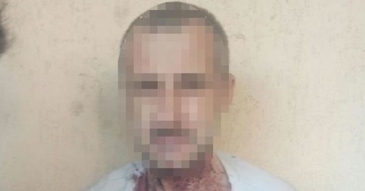 У Києві чоловік порізав вени і шию та намагався стрибнути з моста через наказ "голосу"