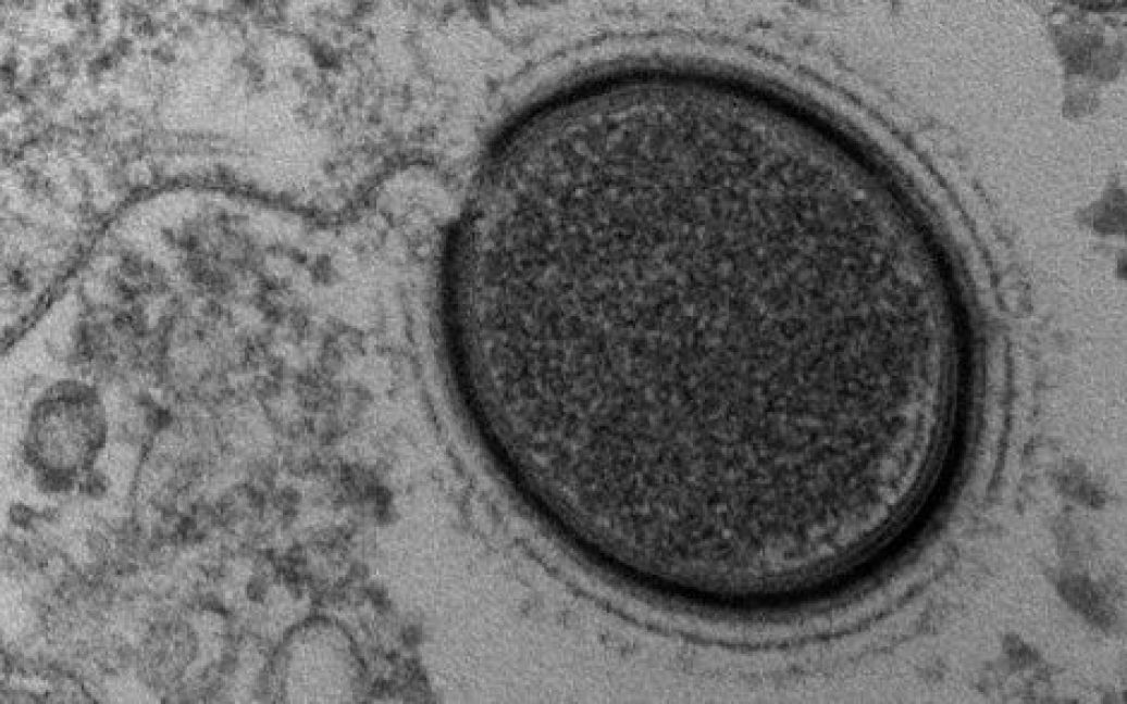 Ученые нашли в Сибири гигантский вирус Mollivirus sibericum / © fusion.net