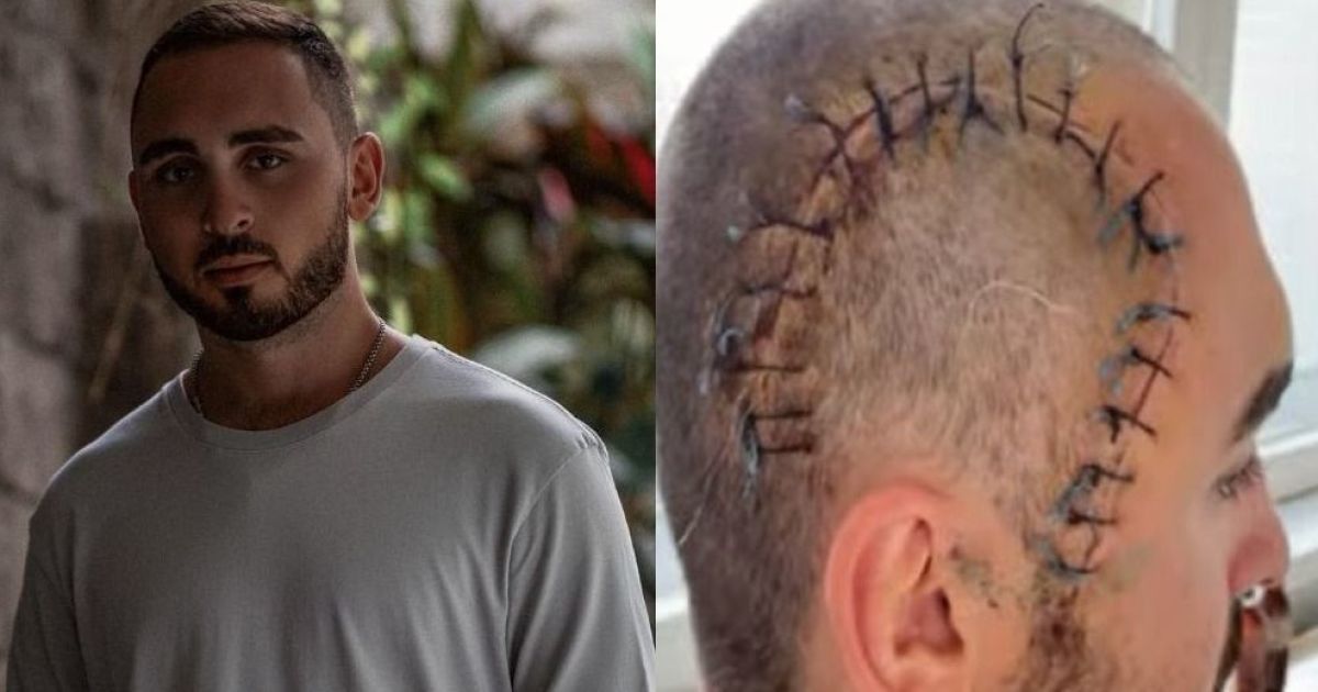 Киевлянин попросил у прохожих сигарету и чуть не умер от удара по голове, теперь он требует правосудия