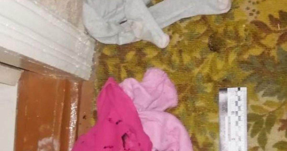 Облив кислотою дружину і 1-річну доньку: миколаївські лікарі розповіли про стан постраждалих