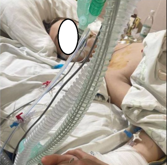 "Трощив техніку, а потім — стрибнув": у Києві 10-річний хлопчик став жертвою "Синього кита"
