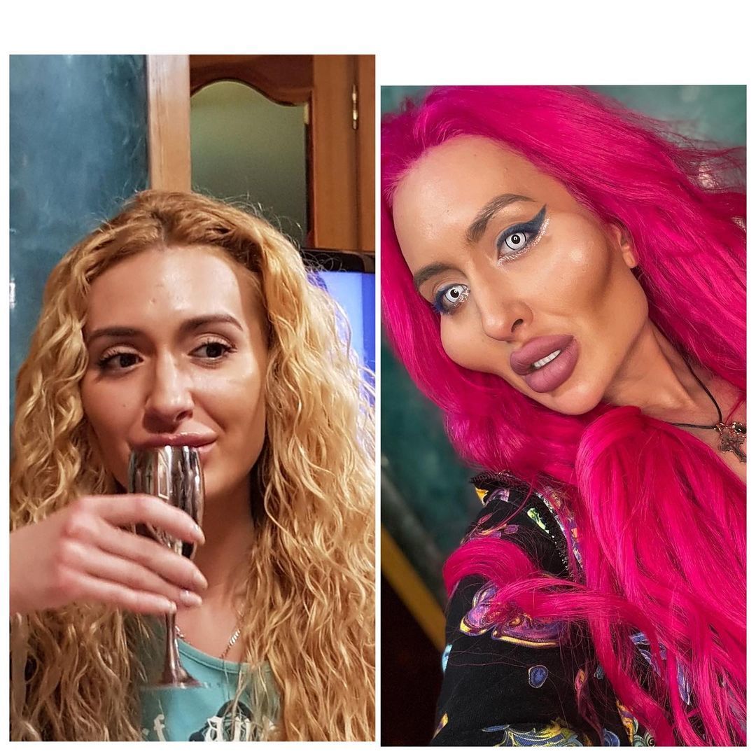 Анастасия Покрещук до и после операции / © instagram.com/_just__queen_