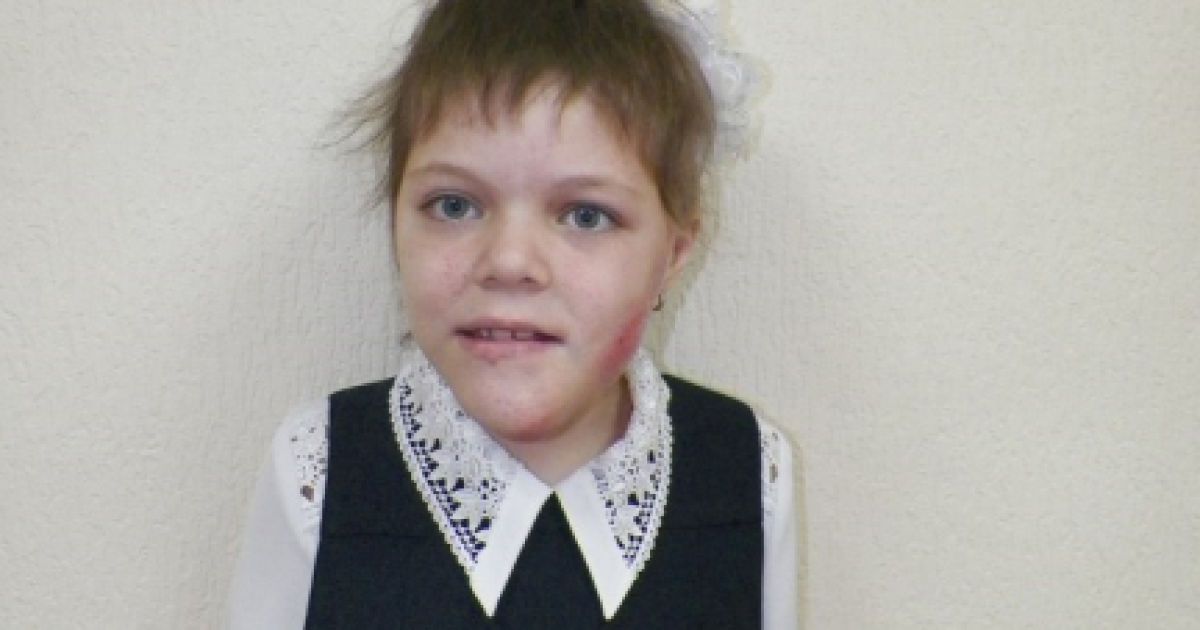 Допомоги небайдужих потребує Каміла