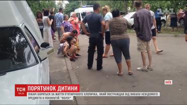 Лікарі "Охматдиту" продовжують боротися за життя 5-річного хлопчика, який постраждав від вибуху у Києві
