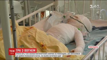 Лікарі прокоментували стан хлопчика, який ледь не згорів живцем на Рівненщині