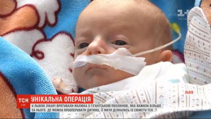 Во Львове врачи спасли малыша с гигантской опухолью, которая весила больше него