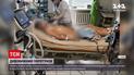 Дивовижний порятунок: львівські медики вивели з мозкової коми 17-річного юнака
