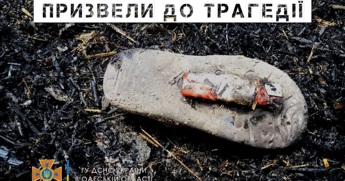 Баловство привело к трагедии: в Одессе умер маленький мальчик, у которого обгорело 98% тела