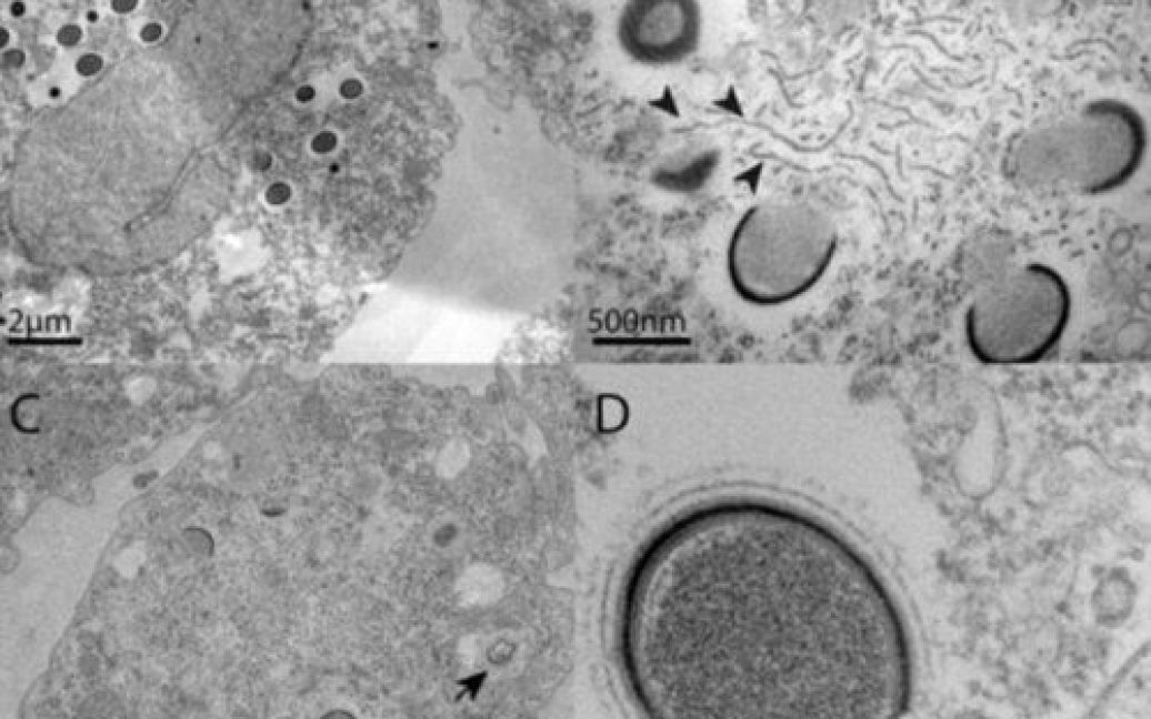 Ученые нашли в Сибири гигантский вирус Mollivirus sibericum / © fusion.net