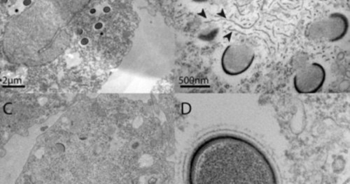 Ученые нашли в Сибири гигантский вирус Mollivirus sibericum