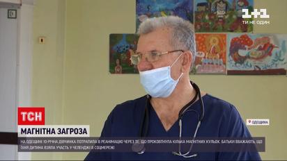 Лікарі врятували школярку, яка у проковтнула магнітні кульки | Новини України
