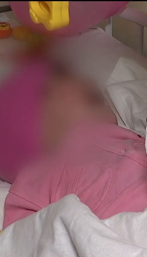 У Дніпрі 11-місячна дівчинка отримала десять переламів через нібито необережність мами