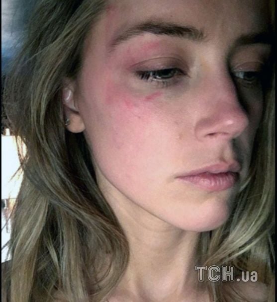 Голливудская пара была в браке 15 месяцев / © East News