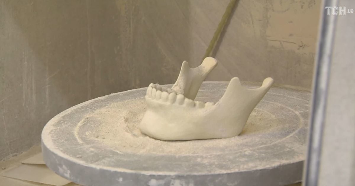 Роздрукована на 3D-принтері щелепа