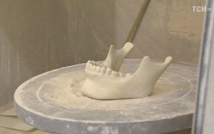 Одесити розробляють технологію друку людських кісток для протезів на 3D-принтері