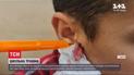В Днепре школьник проткнул себе ухо крючком для вязания
