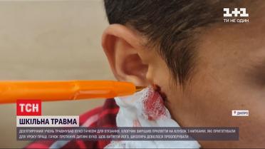 В Днепре школьник проткнул себе ухо крючком для вязания